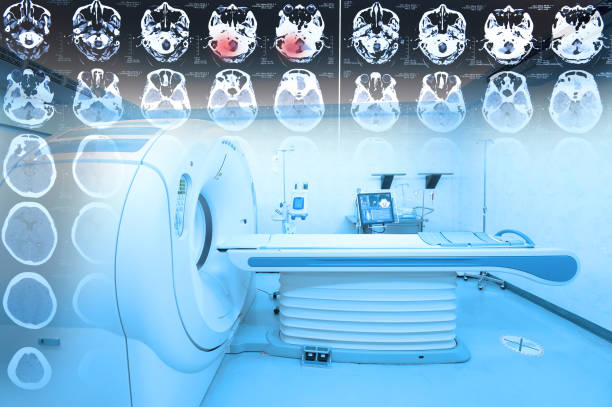 istock MRI scanner room with images from a computerized tomography of the brain 926530066