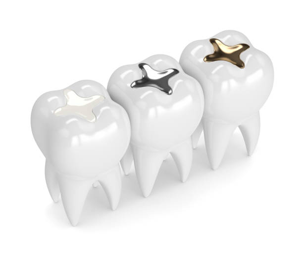 istock 3d render of teeth with different types of dental filling 926536638