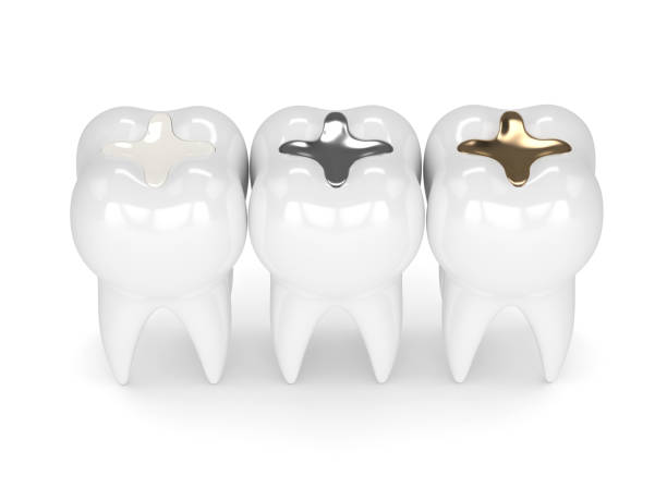 istock 3d render of teeth with different types of dental filling 926537486
