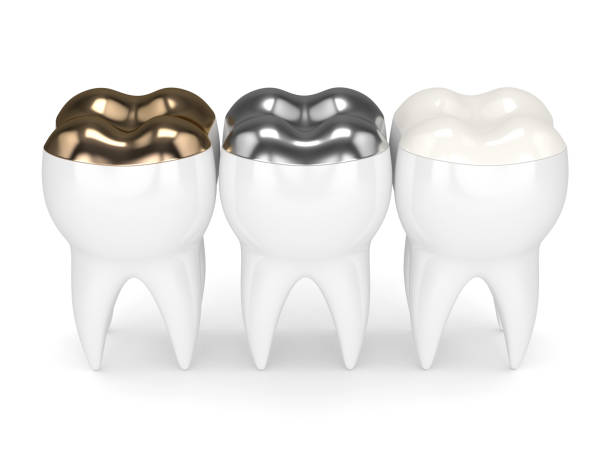 istock 3d render of teeth with different types of dental filling 926553682