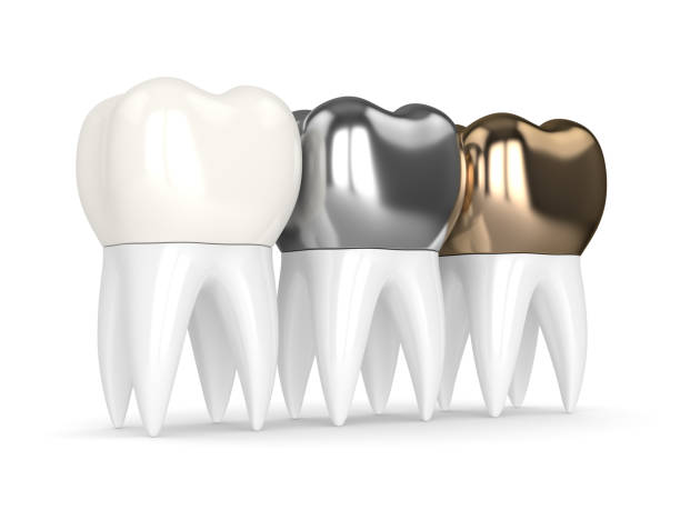 istock 3d render of teeth with different types of dental crown 926558214