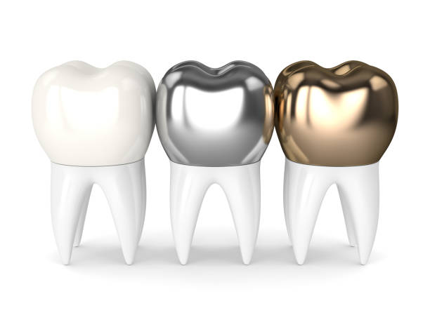 3d render of teeth with different types of dental crown 3d render of teeth with gold, amalgam and composite dental crown over white background dental crown stock pictures, royalty-free photos & images