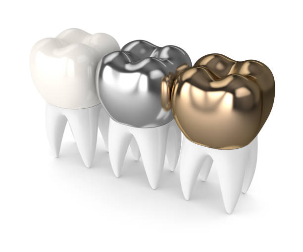 istock 3d render of teeth with different types of dental crown 926559032