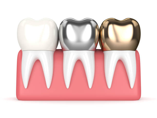 istock 3d render of teeth with different types of dental crown 926559180