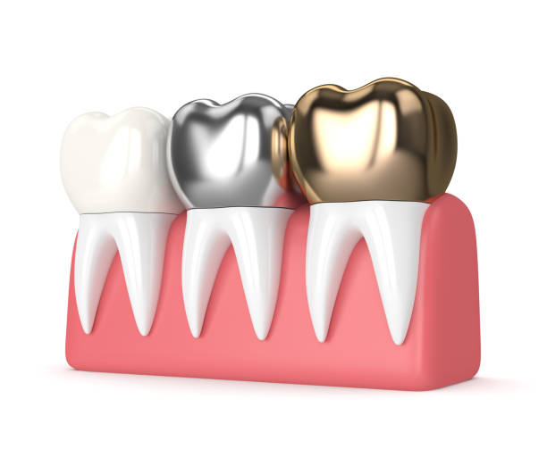 istock 3d render of teeth with different types of dental crown 926584180