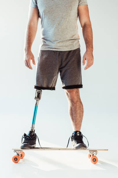 istock man with leg prosthesis standing on skateboard 926610356