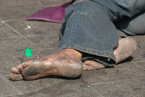 Homeless with bare feet