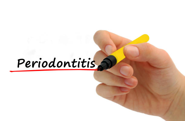 istock Hand writing Periodontitis with red marker 926727514