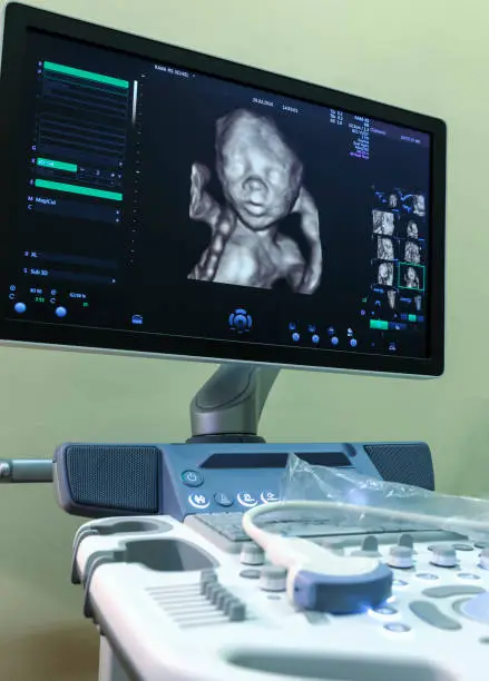 Photo of medical equipment background, close-up ultrasound machine