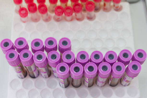 istock test tubes with assays. Blood test. Laboratory. 927752626