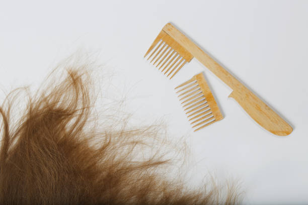 istock Hair and a broken hair brush. 927781538