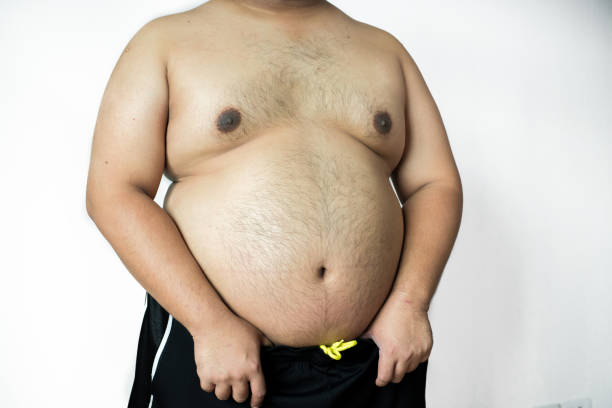 istock Overweight man with big belly on white background in studio. 927794902