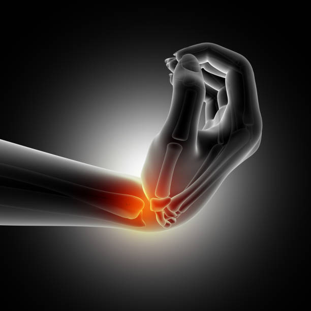 istock 3D medical background showing wrist in bent position 927814224