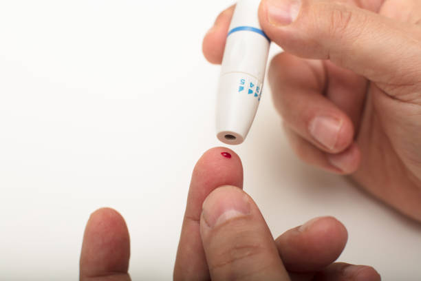 Man pricking his finger with a lancet stock photo