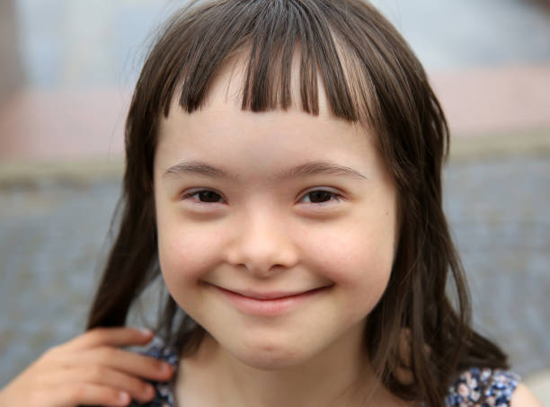 istock Cute smiling down syndrome girl on the grey background 928062322