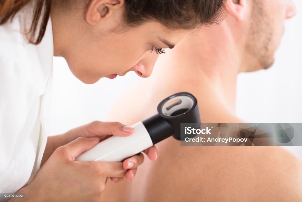Arzt mit Dermatoskop zur Untersuchung der Haut - Lizenzfrei Haut Stock-Foto