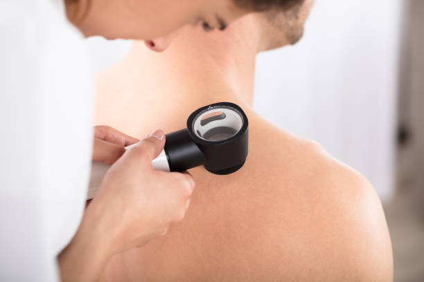istock Doctor Using Dermatoscope For Skin Examination 928070216