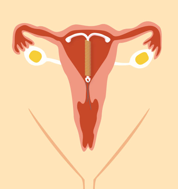 iud 피임 - sexual activity sex couple sensuality stock illustrations