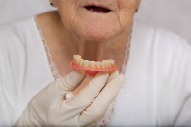 istock Complete denture in the hand of a dentist. 928261398