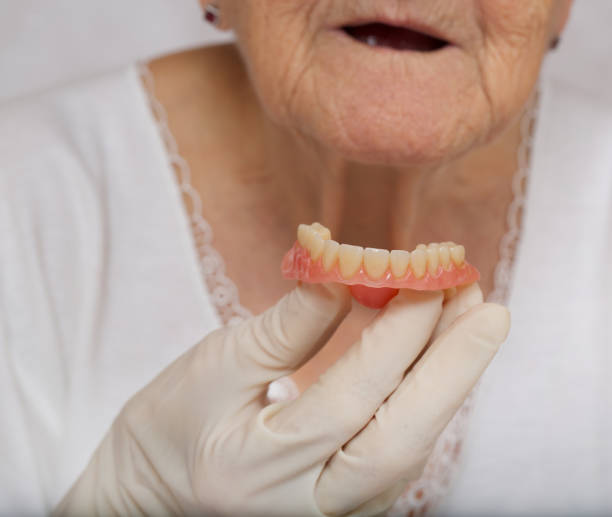 istock Complete denture in the hand of a dentist. 928261426