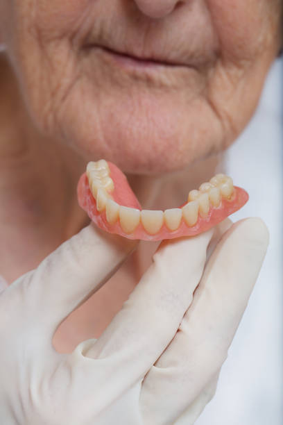 istock Complete denture in the hand of a dentist. 928261462