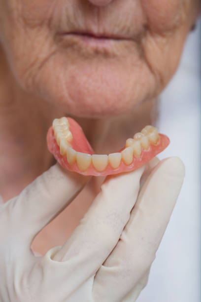 istock Complete denture in the hand of a dentist. 928261464