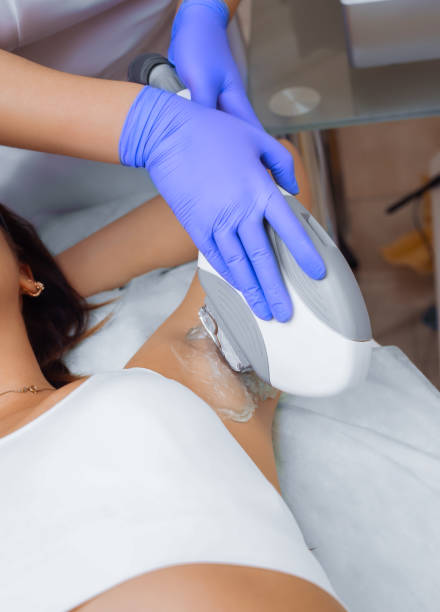 istock Having underarm laser hair removal epilation 928367512