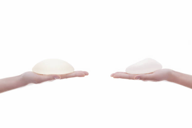dos senos de silicona diferentes implantes en las manos - silicio fotografías e imágenes de stock