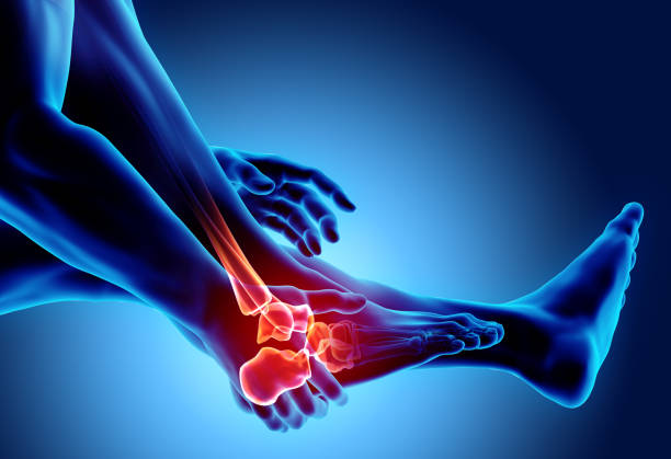 istock Ankle painful - skeleton x-ray. 928441386