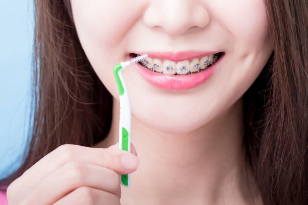 istock woman take interdental brush 928810470