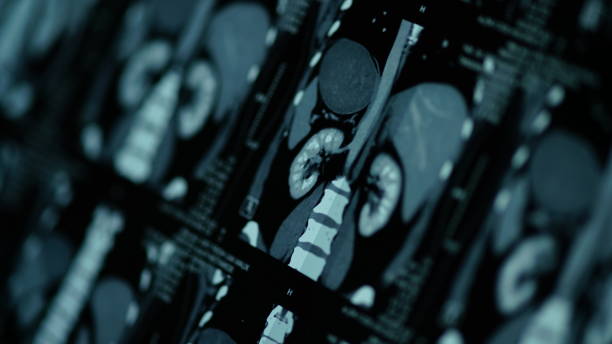 istock Magnetic Resonance Imaging-CT Scanning 928870328