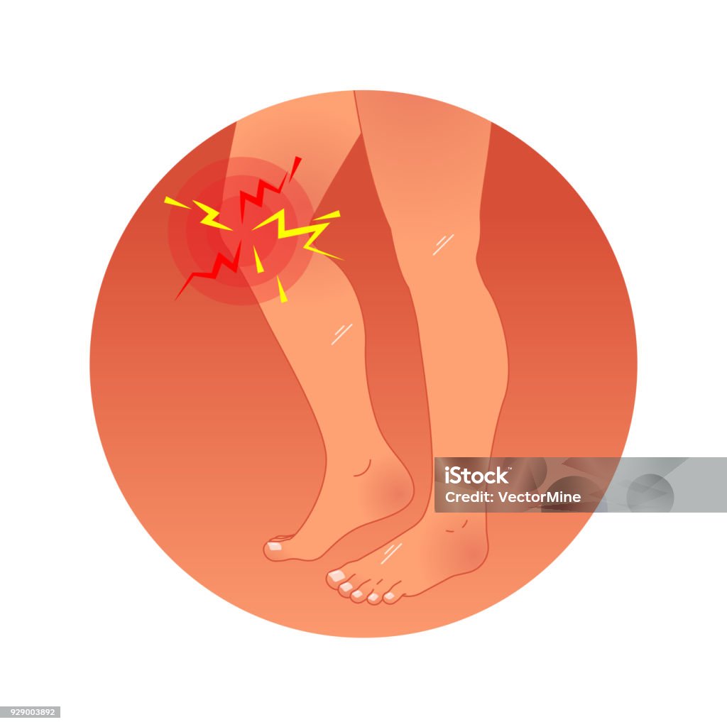 Painful Knee Concept Vector Illustration With Human Legs Graphic Symbol ... Biology Diagrams
