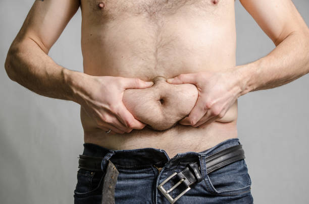 istock Close up on a man grabbing his fat belly 929300256