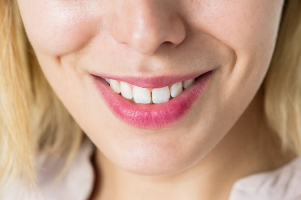 istock Closeup of smiling woman's teeth 929426122