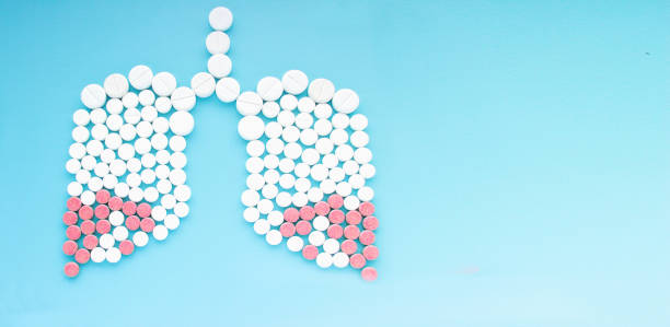 istock Lungs made of pills on blue gradient background. World Tuberculosis Day concept 929811932