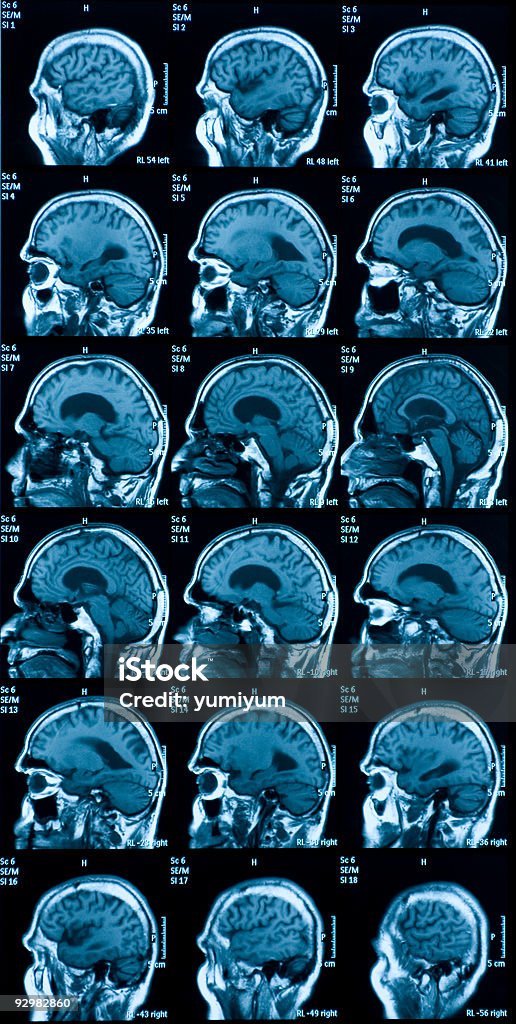 Résonance magnétique images de cerveau - Photo de Cerveau humain libre de droits