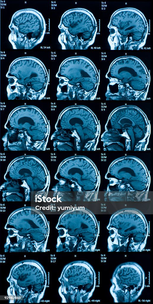 Полученных посредством магнитно-резонансной томографии изображения головного мозга - Стоковые фото Больница роялти-фри