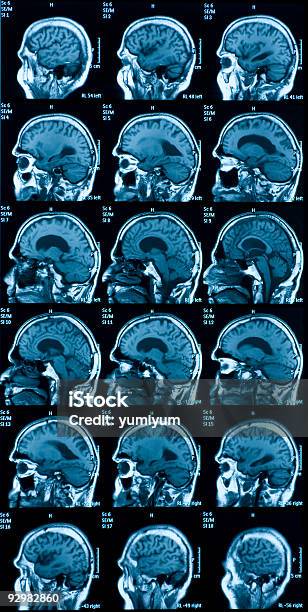 Полученных Посредством Магнитнорезонансной Томографии Изображения Головного Мозга — стоковые фотографии и другие картинки Больница