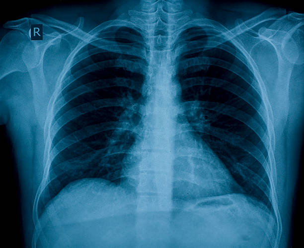 una radiografía de tórax imagen - columna vertebral humana fotos fotografías e imágenes de stock