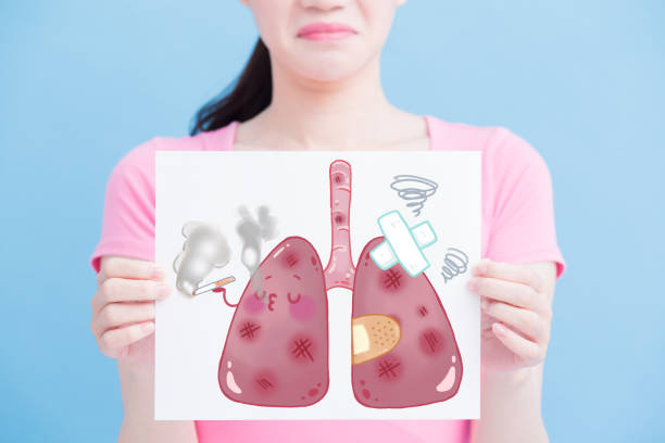 istock woman take unhealth lung billboard 929919050