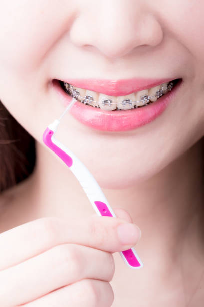 istock woman take interdental brush 929945130