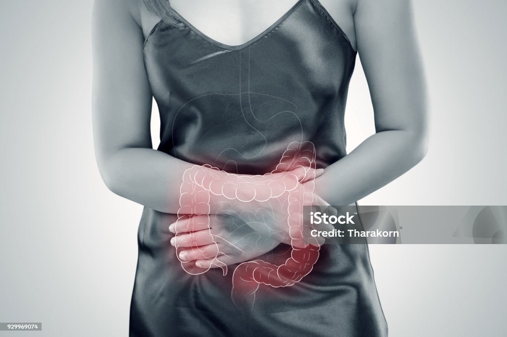 Ulcerative colitis (UC). intestine Ulcerative Colitis, The photo of large intestine is on the woman's body against gray background, Female anatomy, Concept with healthcare and medicine Ulcerative Colitis Stock Photo