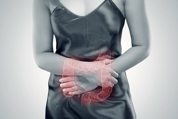 Ulcerative colitis (UC). intestine Ulcerative Colitis, The photo of large intestine is on the woman's body against gray background, Female anatomy, Concept with healthcare and medicine irritable bowel syndrome stock pictures, royalty-free photos & images