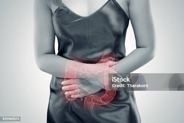 Ulcerative Colitis Intestine Stock Photo - Download Image Now - Ulcerative Colitis, Intestine, Irritable Bowel Syndrome
