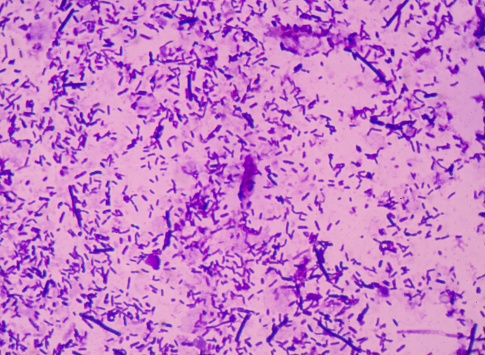 moderate bacteria cells with Gram stain method fide with microscope.
