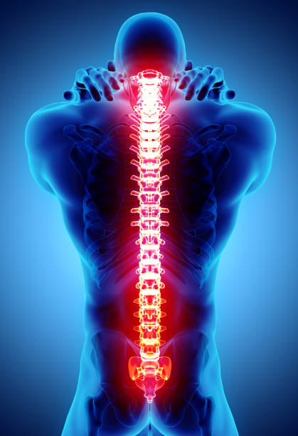 istock 3D Illustration of sacral and cervical painful. 930527896