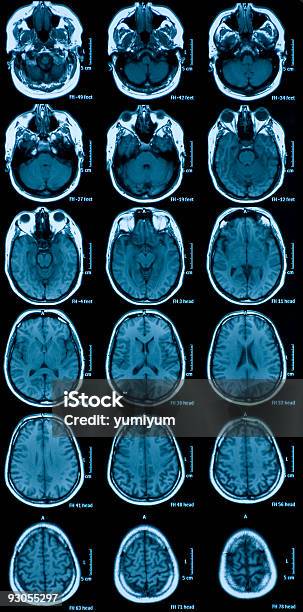 Mri Del Cerebro Foto de stock y más banco de imágenes de Imagen de rayos X - Imagen de rayos X, Asistencia sanitaria y medicina, Cabeza humana