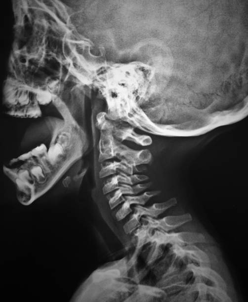 X-ray body part at hospital Child X-ray of neck and head cervical vertebrae photos stock pictures, royalty-free photos & images