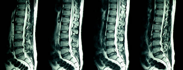resonancia magnética de paciente espinas - espalda partes del cuerpo fotos fotografías e imágenes de stock