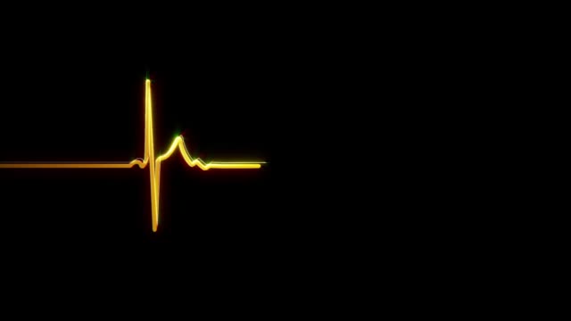 ECG/EKG | Pulse trace